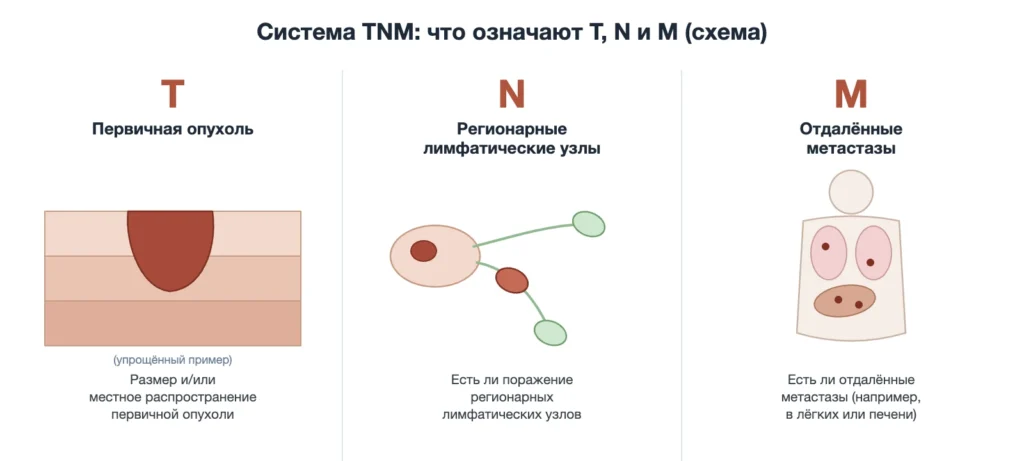 Схема системы TNM: первичная опухоль, регионарные лимфатические узлы и отдалённые метастазы